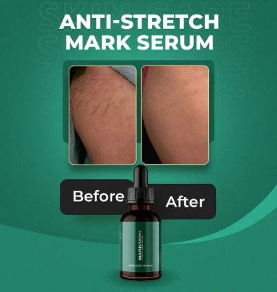 Markaway Stretch Mark Serum – Herbal Formula For Hydration, Toning