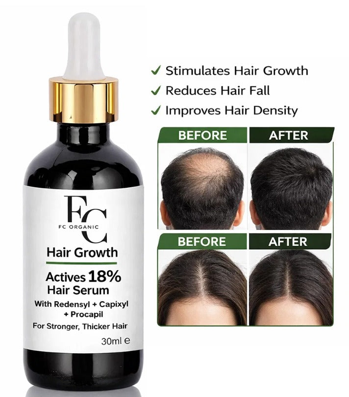 Herbal Hair Growth Serum 30ml | Rosemary &